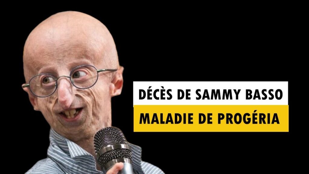 sammy basso progeria